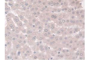 Figure. (Adiponectin Receptor 2 antibody  (AA 1-147))