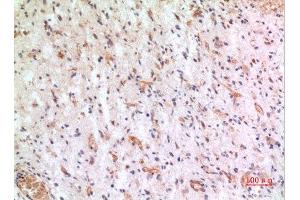 Immunohistochemistry (IHC) analysis of paraffin-embedded Human Brain, antibody was diluted at 1:100. (CX3CL1 antibody  (Internal Region))
