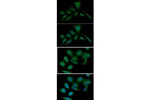 ICC/IF analysis of PKM2 in HeLa cells line, stained with DAPI (Blue) for nucleus staining and monoclonal anti-human PKM2 antibody (1:100) with goat anti-mouse IgG-Alexa fluor 488 conjugate (Green). (PKM antibody  (AA 1-531))