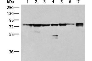 Western blot analysis of 231 K562 TM4 cell Mouse kidney tissue Mouse liver tissue Mouse brain tissue Hela cell lysates using THNSL1 Polyclonal Antibody at dilution of 1:500 (THNSL1 antibody)