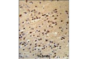 ALS2 Antibody (C-term) (R) IHC analysis in formalin fixed and paraffin embedded human brain tissue followed by peroxidase conjugation of the secondary antibody and DAB staining. (ALS2 antibody  (C-Term))