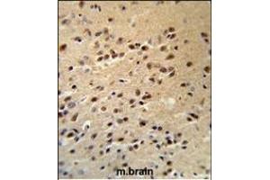 ALS2 Antibody (C-term) (R) IHC analysis in formalin fixed and paraffin embedded human brain tissue followed by peroxidase conjugation of the secondary antibody and DAB staining.