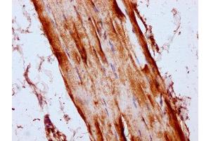 IHC image of ABIN7158674 diluted at 1:300 and staining in paraffin-embedded human skeletal muscle tissue performed on a Leica BondTM system. (LYRM4 antibody  (AA 1-91))