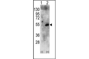 Image no. 1 for anti-Ribosomal Protein S6 Kinase, 70kDa, Polypeptide 2 (RPS6KB2) (Middle Region) antibody (ABIN360434) (RPS6KB2 antibody  (Middle Region))