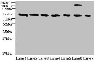 Western blot All lanes: TRPM2 antibody at 3 μg/mL Lane 1: HepG2 whole cell lysate Lane 2: Mouse brain tissue Lane 3: A549 whole cell lysate Lane 4: K562 whole cell lysate Lane 5: Mouse kidney tissue Lane 6: Human placenta tissue Lane 7: Mouse spleen tissue Secondary Goat polyclonal to rabbit IgG at 1/10000 dilution Predicted band size: 172, 166, 96 kDa Observed band size: 70 kDa (TRPM2 antibody  (AA 60-119))