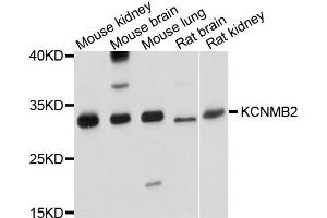 Western blot analysis of extract of various cells, using KCNMB2 antibody. (KCNMB2 antibody)