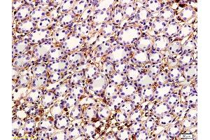 Formalin-fixed and paraffin embedded rabbit kidney tissue labeled with Anti-VEGF Polyclonal Antibody, Unconjugated (ABIN674829) followed by conjugation to the secondary antibody and DAB staining (VEGF antibody)