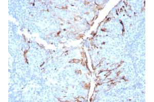 Formalin-fixed, paraffin-embedded human tonsil stained with Mesothelin Mouse Monoclonal Antibody (MSLN/3384).