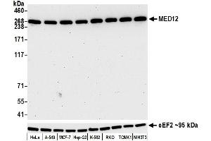 Western Blotting (WB) image for anti-Mediator Complex Subunit 12 (MED12) (AA 2127-2177) antibody (ABIN7453977) (Recombinant MED12 antibody  (AA 2127-2177))