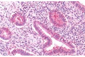 Human, Uterus: Formalin-Fixed Paraffin-Embedded (FFPE) (GPRC5A antibody  (Cytoplasmic Domain))