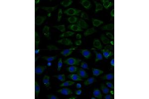 Immunofluorescence analysis of L929 cells using NDUFB7 Polyclonal Antibody (ABIN6132403, ABIN6144480, ABIN6144481 and ABIN6217781) at dilution of 1:100 (40x lens). (NDUFB7 antibody  (AA 1-137))