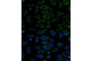 Immunofluorescence analysis of L929 cells using NDUFB7 Polyclonal Antibody (ABIN6132403, ABIN6144480, ABIN6144481 and ABIN6217781) at dilution of 1:100 (40x lens).