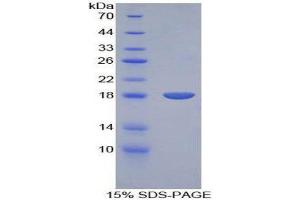 SDS-PAGE (SDS) image for Bone Morphogenetic Protein 15 (BMP15) (AA 269-391) protein (His tag) (ABIN1878970)