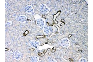 Immunohistochemistry (IHC) image for anti-Keratin 18 (KRT18) (AA 204-430) antibody (ABIN5518769)
