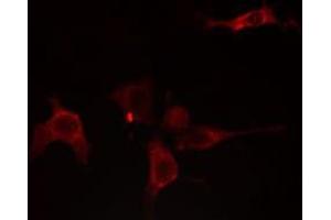 ABIN6275754 staining NIH-3T3 cells by IF/ICC. (GNE antibody)