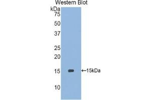 Detection of Recombinant SEPX1, Human using Polyclonal Antibody to Selenoprotein X1 (SEPX1) (MSRB1 antibody  (AA 1-116))