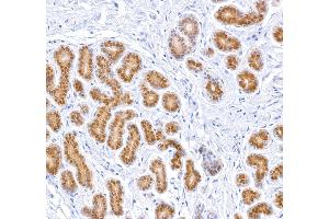 Immunohistochemistry (IHC) image for anti-Signal Transducer and Activator of Transcription 5A (STAT5A) (AA 744-794) antibody (ABIN7454017) (Recombinant STAT5A antibody  (AA 744-794))