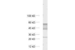 dilution: 1 : 1000, sample: unboiled rat cerebellum lysate (GABRA6 antibody  (AA 20-30))