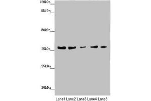 Western blot All lanes: MTHFD2 antibody at 4. (MTHFD2 antibody  (AA 40-250))