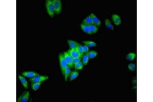 Immunofluorescent analysis of HepG2 cells using ABIN7149659 at dilution of 1:100 and Alexa Fluor 488-congugated AffiniPure Goat Anti-Rabbit IgG(H+L) (ECH1 antibody  (AA 36-135))