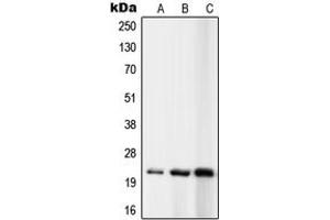 Western blot analysis of RPL10 expression in K562 (A), MCF7 (B), Ramos (C) whole cell lysates. (RPL10 antibody  (N-Term))
