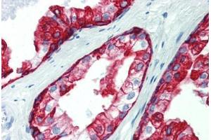 Prostate, Human: Formalin-Fixed, Paraffin-Embedded (FFPE) (Cytokeratin 19 antibody  (C-Term))