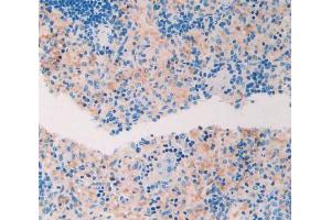 IHC-P analysis of spleen tissue, with DAB staining.