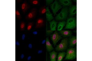 ABIN6258395 and ABIN6275065 staining  cells by IF/ICC.