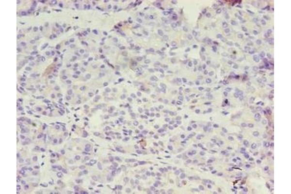 DPH1 antibody  (AA 192-318)