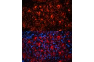 Immunofluorescence (IF) image for anti-Lipocalin 2 (LCN2) (AA 1-100) antibody (ABIN3017526)