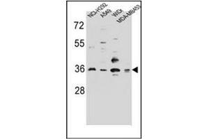 Western blot analysis of RIC3 Antibody (C-term) in NCI-H292,A549,WiDr,MDA-MB453 cell line lysates (35ug/lane).