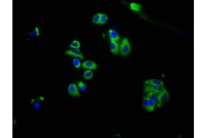 Immunofluorescence staining of HepG2 cells with ABIN7159436 at 1:66, counter-stained with DAPI. (GRM2 antibody  (AA 93-221))