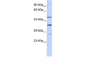WB Suggested Anti-MEF2B Antibody Titration:  0. (MEF2B antibody  (N-Term))