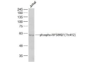 Jurkat lysates probed with RPS6KB1(Thr412) Polyclonal Antibody, Unconjugated  at 1:300 dilution and 4˚C overnight incubation.