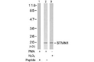 Image no. 2 for anti-Stathmin 1 (STMN1) (Ser15) antibody (ABIN197474) (Stathmin 1 antibody  (Ser15))