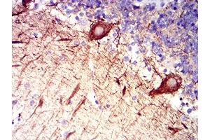 Immunohistochemical analysis of paraffin-embedded cerebellum tissues using RAB27B mouse mAb with DAB staining.