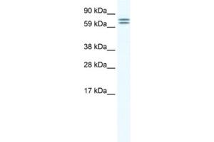 Western Blotting (WB) image for anti-Carboxylesterase 4A (CES4A) antibody (ABIN2461535)