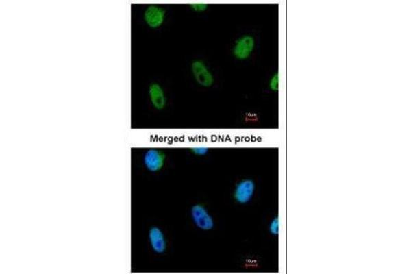 L3MBTL1 antibody  (Center)