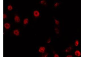 ABIN6266869 staining LOVO by IF/ICC. (TRIP13 antibody  (C-Term))