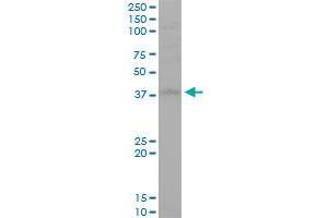 STYK1 monoclonal antibody (M02), clone 3D2. (STYK1 antibody  (AA 50-159))