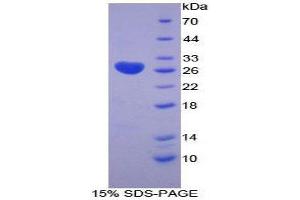 SDS-PAGE (SDS) image for Lysyl Oxidase-Like 3 (LOXL3) (AA 519-726) protein (His tag) (ABIN2125758)