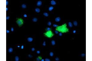 Image no. 1 for anti-Carboxypeptidase A1 (Pancreatic) (CPA1) antibody (ABIN1497591) (CPA1 antibody)