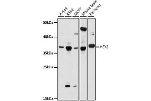 Western blot analysis of extracts of various cell lines, using HEY2 antibody (ABIN6294032) at 1:1000 dilution. (HEY2 antibody)