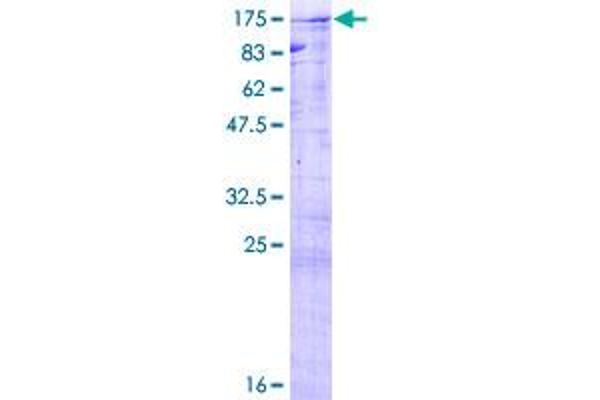 CDC5L Protein (AA 1-802) (GST tag)