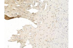 ABIN7094752 and ABIN7098803 at 1/100 staining Rat brain tissue by IHC-P.
