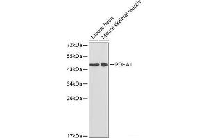Western blot analysis of extracts of various cell lines using PDHA1 Polyclonal Antibody at dilution of 1:1000. (PDHA1 antibody)