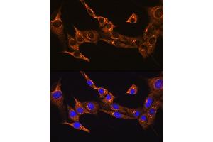 Immunofluorescence analysis of NIH/3T3 cells using BDKRB2 Rabbit pAb (ABIN3016822, ABIN3016823, ABIN3016824 and ABIN6219849) at dilution of 1:100. (BDKRB2 antibody  (AA 302-391))
