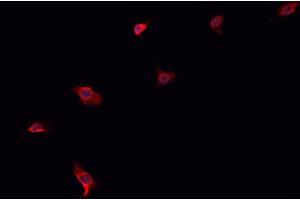 ABIN6276936 staining HepG2? (ABCG8 antibody  (Internal Region))