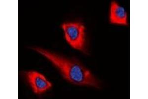 Immunofluorescent analysis of PEA15 staining in HEK293T cells. (PEA15 antibody)