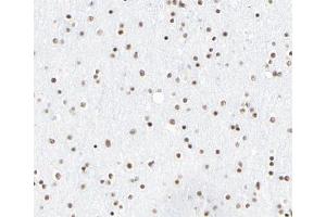 ABIN6266702 at 1/100 staining human brain tissue sections by IHC-P. (CLOCK antibody  (Internal Region))